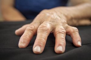 Remedii naturale pentru tratarea artritei
